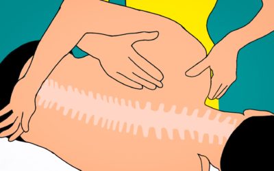 Lesione lieve entità